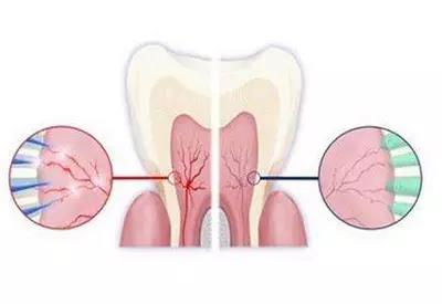 美牙记,健康小知识:如何应对牙齿敏感